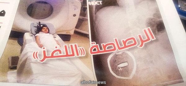 الصحة تقر بإغلاق الجرح على الرصاصة